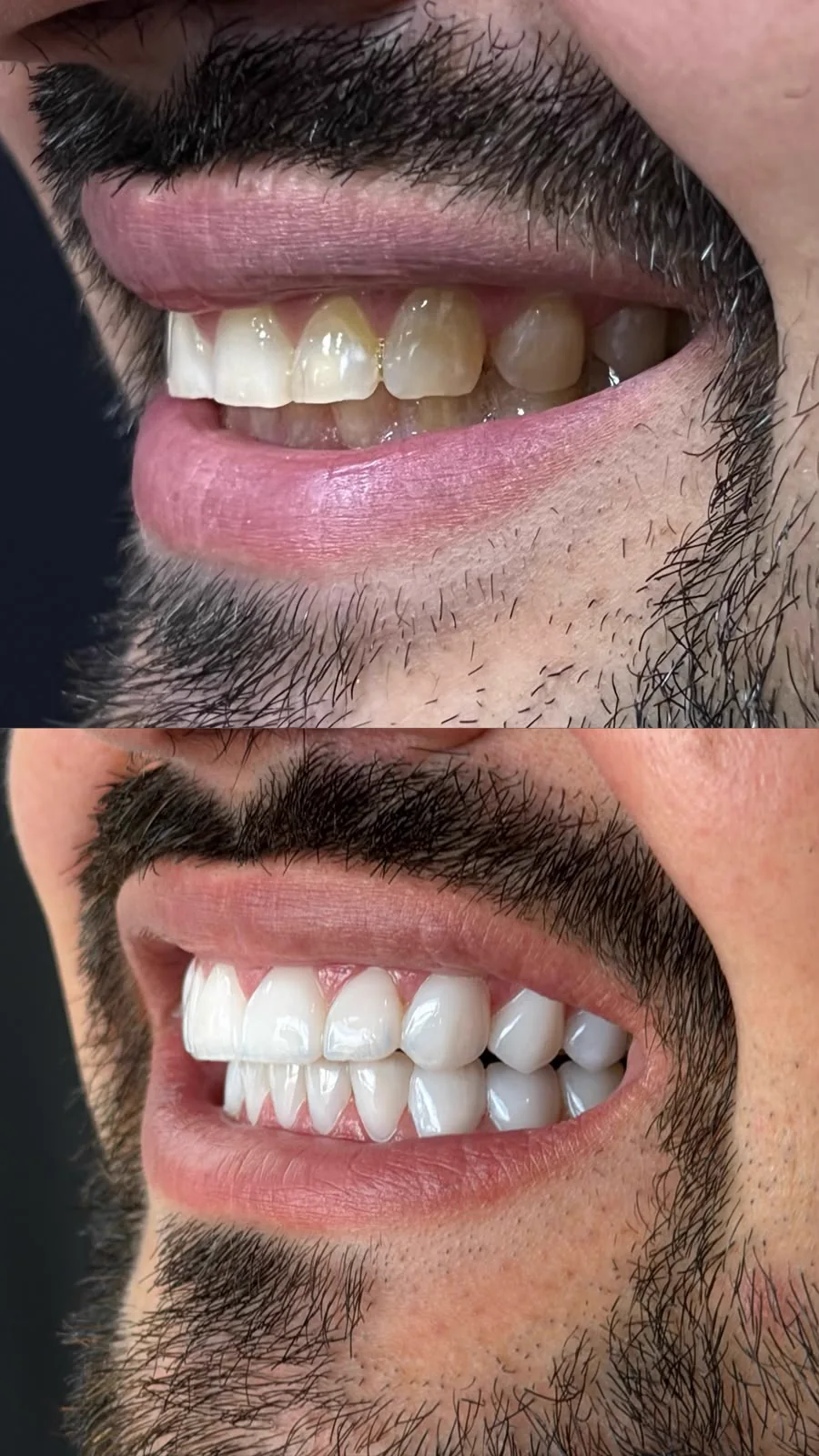 Comparativo de resultado odontológico antes e depois