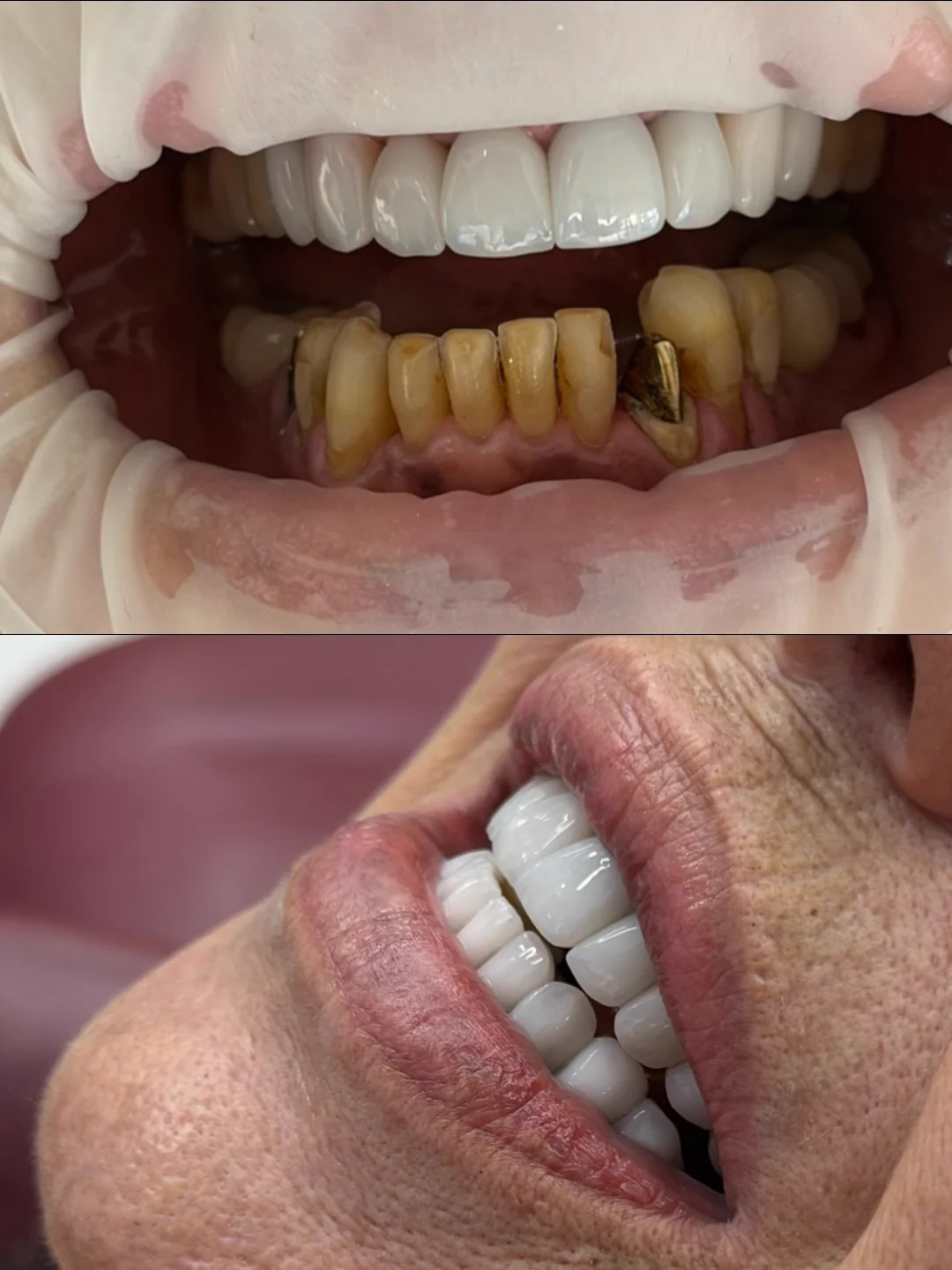 Comparativo de resultado odontológico antes e depois